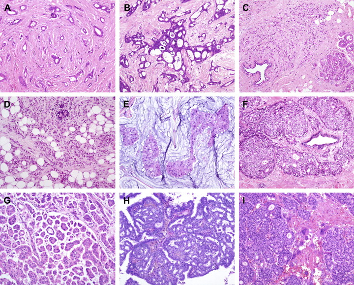 HistologyImageClassification